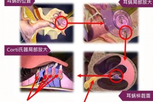 汕头惠耳----人工耳蜗与助听器